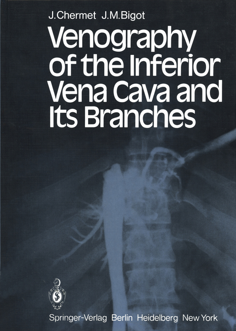 Venography of the Inferior Vena Cava and Its Branches - J. Chermet, J. M. Bigot