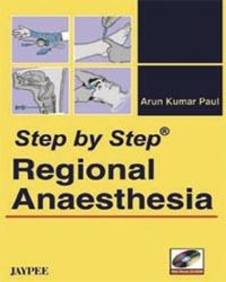 Step by Step: Regional Anaesthesia - Arun Kumar Paul