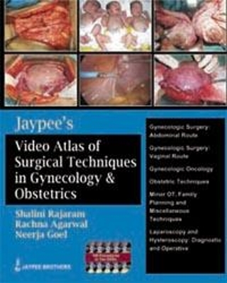 Jaypee's Video Atlas of Surgical Techniques in Gynecology and Obstetrics - Shalini Rajaram, Rachna Agarwal, Neerja Goel