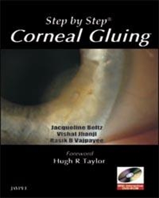 Step by Step: Corneal Gluing - Rasik B Vajpayee, Jacqueline Beltz, Vishal Jhanji