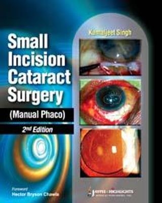 Small Incision Cataract Surgery (Manual Phaco) - Kamaljeet Singh