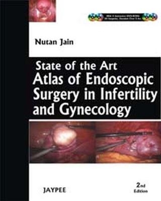 State-of-the-Art Atlas of Endoscopic Surgery in Infertility and Gynecology - Nutan Jain