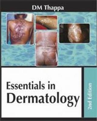 Essentials in Dermatology - DM Thappa