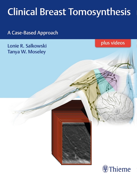 Clinical Breast Tomosynthesis - Lonie Salkowski