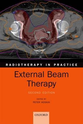 External Beam Therapy - 