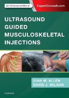 Ultrasound Guided Musculoskeletal Injections - Gina M Allen, David John Wilson