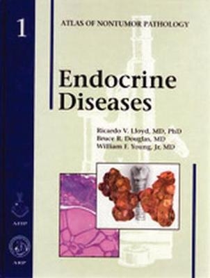 Endocrine Diseases - Ricardo V. Lloyd, Bruce R. Douglas, William F. Young Jr