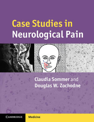 Case Studies in Neurological Pain - Claudia Sommer, Douglas W. Zochodne