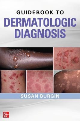 Guidebook to Dermatologic Diagnosis - Susan Burgin