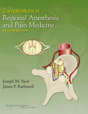 Complications in Regional Anesthesia and Pain Medicine - James Rathmell, Joseph Neal