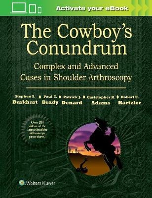 The Cowboy's Conundrum: Complex and Advanced Cases in Shoulder Arthroscopy - Stephen S. Burkhart