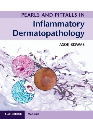 Pearls and Pitfalls in Inflammatory Dermatopathology - Asok Biswas