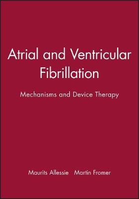 Atrial and Ventricular Fibrillation - 