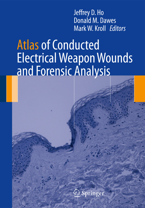 Atlas of Conducted Electrical Weapon Wounds and Forensic Analysis - 