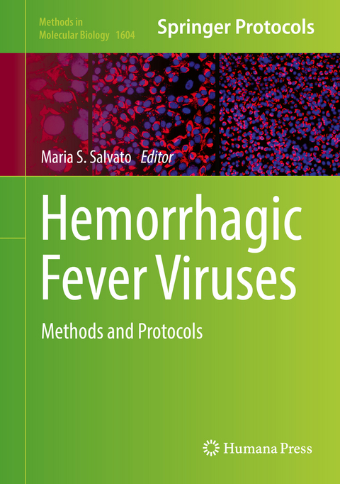 Hemorrhagic Fever Viruses - 