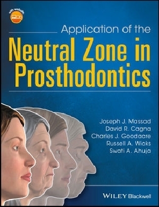 Application of the Neutral Zone in Prosthodontics - Joseph J. Massad, David R. Cagna, Charles J. Goodacre, Russell A. Wicks, Swati A. Ahuja