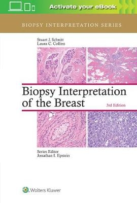 Biopsy Interpretation of the Breast - Stuart J. Schnitt, Laura C. Collins