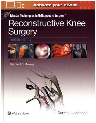 Master Techniques in Orthopaedic Surgery: Reconstructive Knee Surgery - Dr. Darren L. Johnson