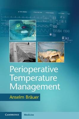 Perioperative Temperature Management - Anselm Bräuer