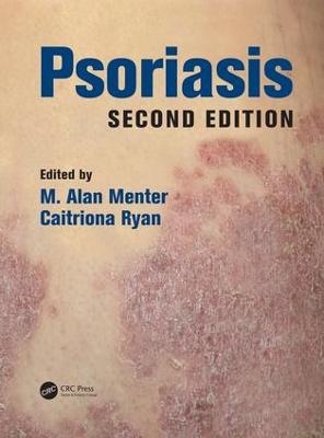 Psoriasis - 