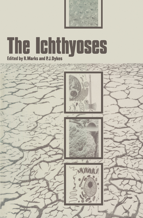 The Ichthyoses - 