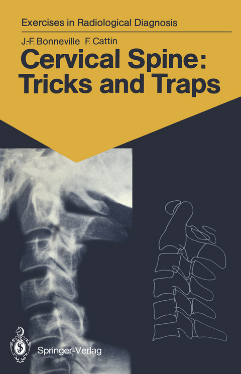 Cervical Spine: Tricks and Traps - Jean-Francois Bonneville, Francoise Cattin