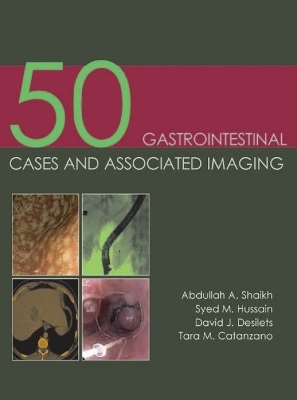 50 Gastrointestinal Cases and Associated Imaging - Dr Abdullah A. Shaikh, Dr Syed M. Hussain, Dr David J Desilets, Dr Tara M. Catanzano