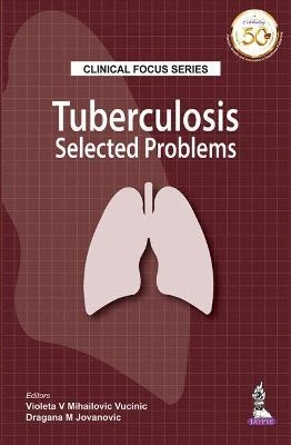 Clinical Focus Series: Tuberculosis - Violeta Mihailovic-Vucinic, Dragana M. Jovanovic
