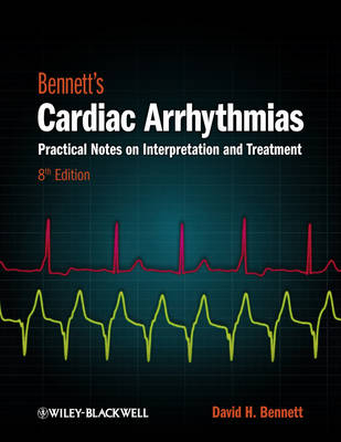 Bennett's Cardiac Arrhythmias - David H. Bennett