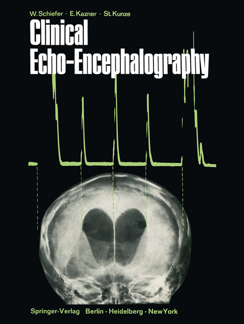 Clinical Echo-Encephalography - Wolfgang Schiefer, Ekkehard Kazner, Stefan Kunze