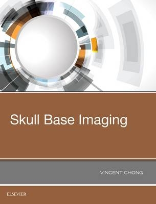 Skull Base Imaging - Vincent Chong