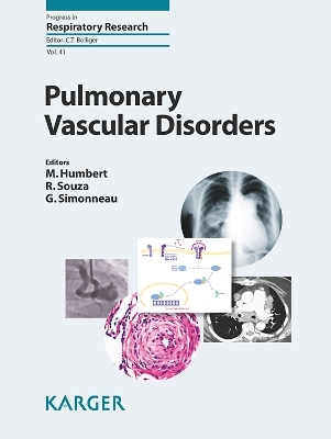 Pulmonary Vascular Disorders - 