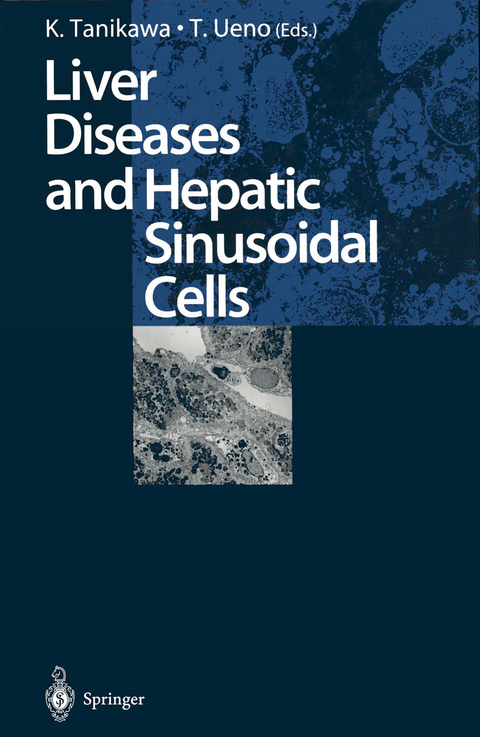 Liver Diseases and Hepatic Sinusoidal Cells - 