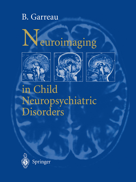 Neuroimaging in child neuropsychiatric disorders - 