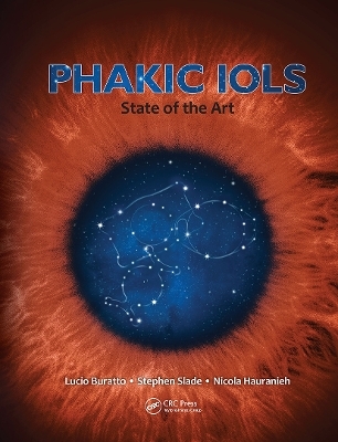 Phakic IOLs - Lucio Buratto, Stephen Slade, Nicola Hauranieh