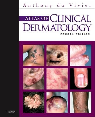 Atlas of Clinical Dermatology - Anthony du Vivier