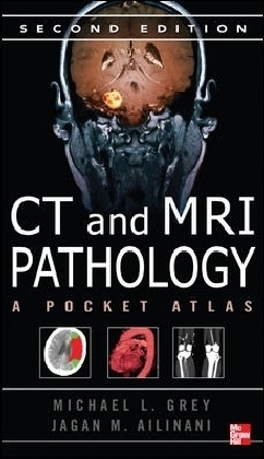 CT & MRI Pathology: A Pocket Atlas, Second Edition - Michael Grey, Jagan Ailinani