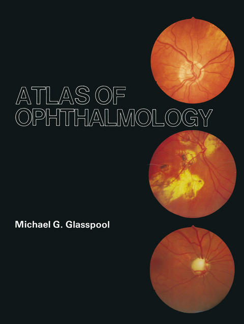 Atlas of Ophthalmology - M.G. Glasspool