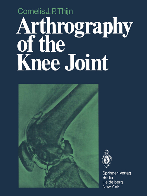 Arthrography of the Knee Joint - C.J.P. Thijn