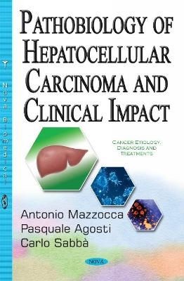 Pathobiology of Hepatocellular Carcinoma & Clinical Impact - Antonio Mazzocca, Pasquale Agosti, Carlo Sabbá