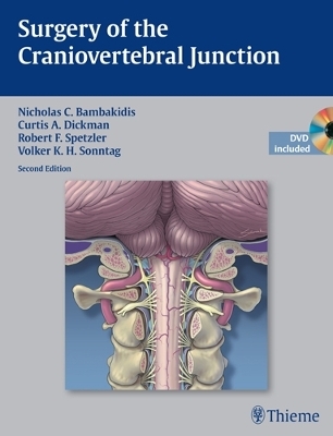 Surgery of the Craniovertebral Junction - 
