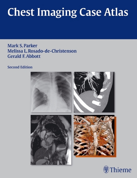 Chest Imaging Case Atlas - Mark S. Parker, Melissa L. Rosado-de-Christenson, Gerald F. Abbott