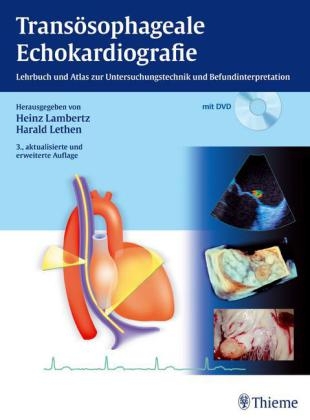 Transösophageale Echokardiographie - Heinz Lambertz, Harald Lethen