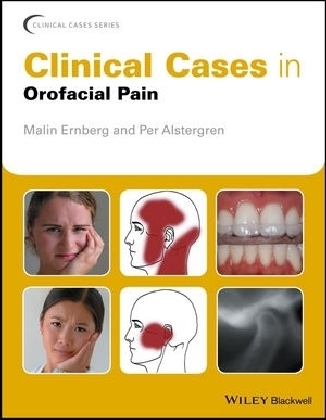 Clinical Cases in Orofacial Pain - Malin Ernberg, Per Alstergren