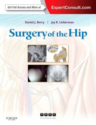 Surgery of the Hip - Daniel J. Berry, Jay Lieberman