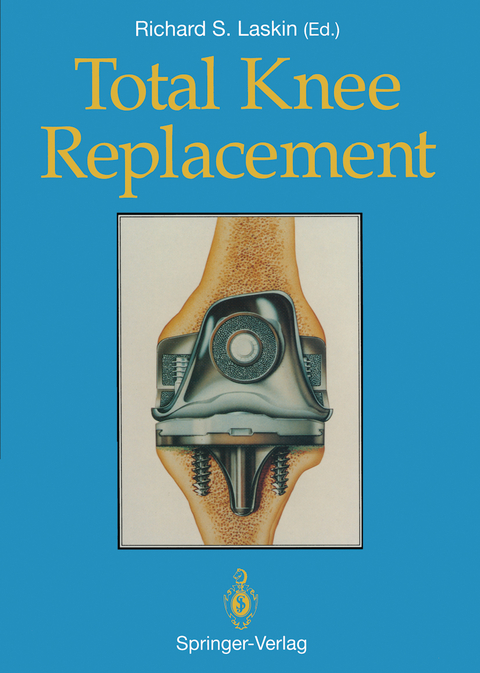 Total Knee Replacement - 