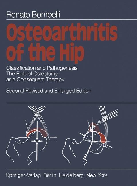 Osteoarthritis of the Hip - Renato Bombelli