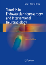 Tutorials in Endovascular Neurosurgery and Interventional Neuroradiology -  James Vincent Byrne