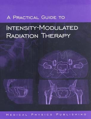 A Practical Guide to Intensity-Modulated Radiation Therapy - Memorial Sloan-Kettering Cancer Center