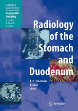 Radiology of the Stomach and Duodenum - 